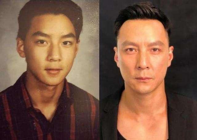 在这个看脸的世界,男生这款发型最容易导致脱发?你剪过吗?